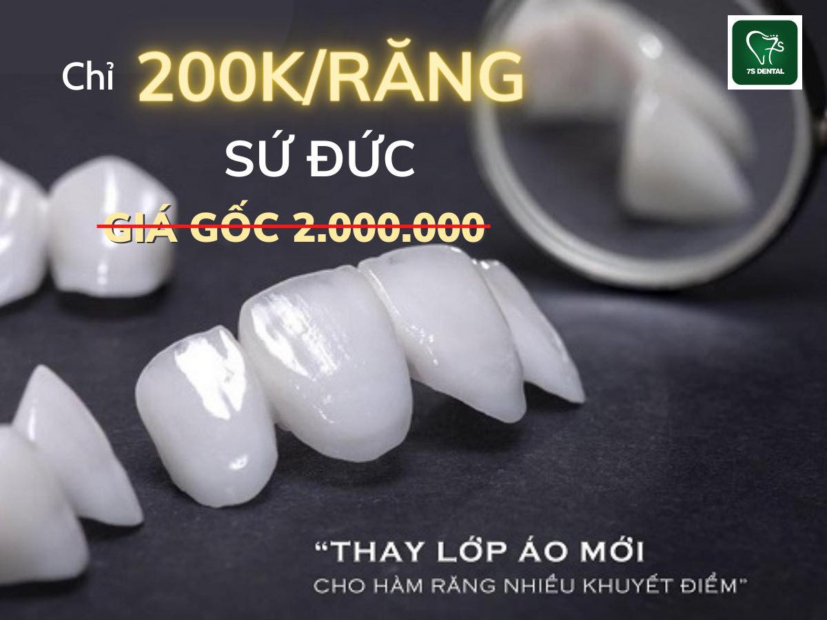Răng sứ